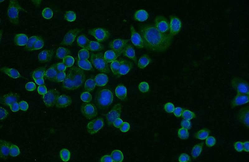 Immunofluorescent analysis of COLO 320 cells using Catalog No:116301(TRIM17 Antibody) at dilution of 1:25 and Alexa Fluor 488-congugated AffiniPure Goat Anti-Rabbit IgG(H+L)