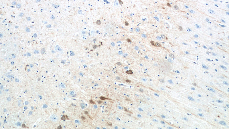 Immunohistochemistry of paraffin-embedded human brain tissue slide using Catalog No:108909(Calretinin Antibody) at dilution of 1:200 (under 10x lens).