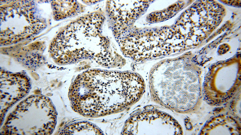 Immunohistochemical of paraffin-embedded human testis using Catalog No:116460(TXNRD3 antibody) at dilution of 1:50 (under 10x lens)