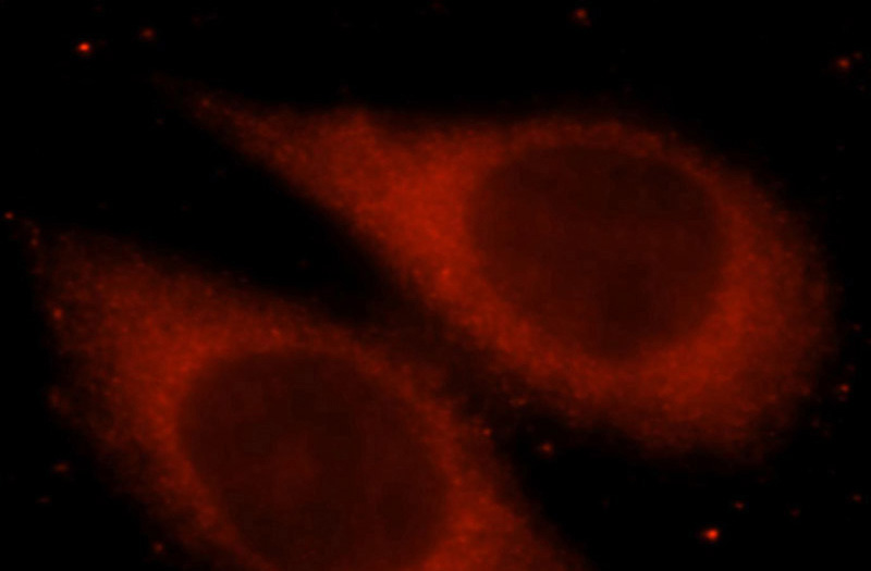 Immunofluorescent analysis of Hela cells, using SPR antibody Catalog No:115641 at 1:25 dilution and Rhodamine-labeled goat anti-rabbit IgG (red).
