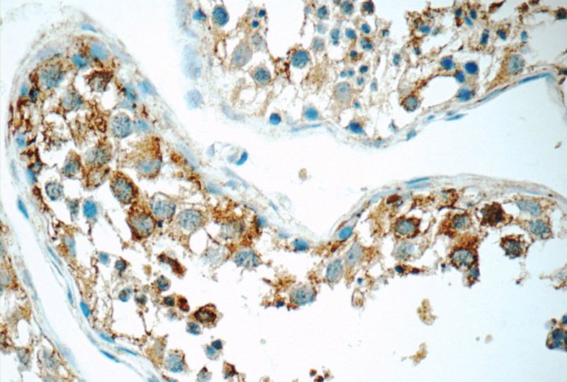 Immunohistochemistry of paraffin-embedded human testis tissue slide using Catalog No:115912(TCN1 Antibody) at dilution of 1:50 (under 40x lens)
