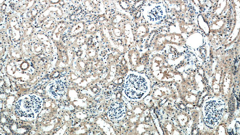 Immunohistochemical of paraffin-embedded human kidney using Catalog No:110721(FZD10 antibody) at dilution of 1:100 (under 10x lens)