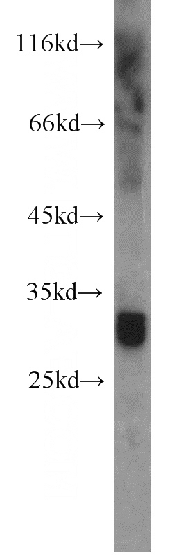 human heart tissue were subjected to SDS PAGE followed by western blot with Catalog No:115335(SLC25A4 antibody) at dilution of 1:800
