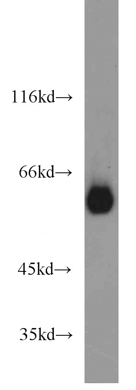 HL-60 cells were subjected to SDS PAGE followed by western blot with Catalog No:109757(DCT antibody) at dilution of 1:1000