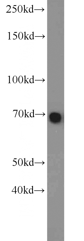 HeLa cells were subjected to SDS PAGE followed by western blot with Catalog No:115887(TBX18 antibody) at dilution of 1:1000