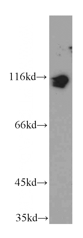 HT-1080 cells were subjected to SDS PAGE followed by western blot with Catalog No:112023(KDM1 antibody) at dilution of 1:600