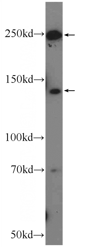 mouse liver tissue were subjected to SDS PAGE followed by western blot with Catalog No:108023(APOB Antibody) at dilution of 1:600