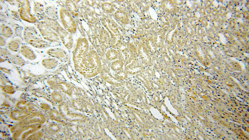 Immunohistochemical of paraffin-embedded human kidney using Catalog No:109689(CYP27A1 antibody) at dilution of 1:100 (under 10x lens)