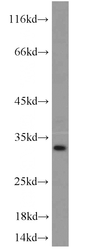 HL-60 cells were subjected to SDS PAGE followed by western blot with Catalog No:116447(TSPAN2 antibody) at dilution of 1:500