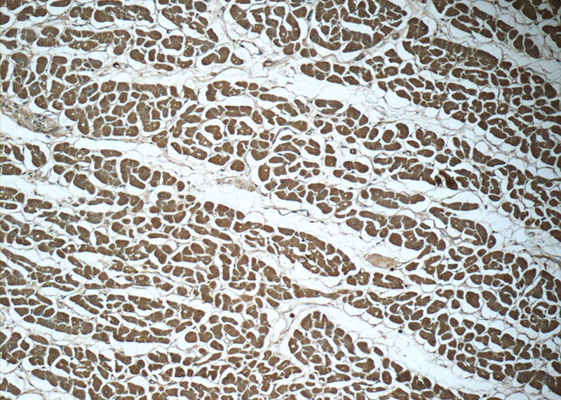 Immunohistochemistry of paraffin-embedded human heart tissue slide using Catalog No:116599(USP21 Antibody) at dilution of 1:50 (under 10x lens)