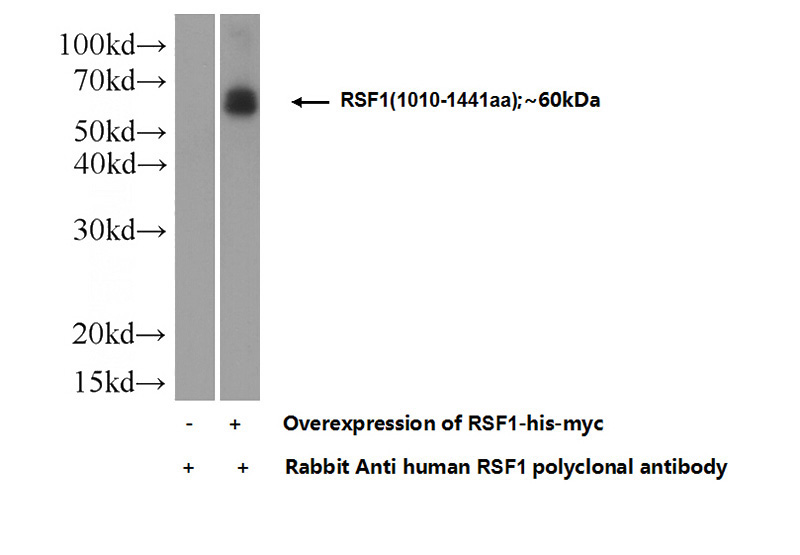 Transfected HEK-293 cells were subjected to SDS PAGE followed by western blot with Catalog No:114934(RSF1 Antibody) at dilution of 1:1000