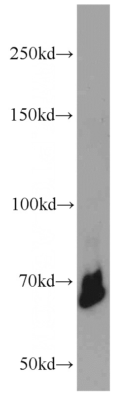 Jurkat cells were subjected to SDS PAGE followed by western blot with Catalog No:117347(YY1 antibody) at dilution of 1:1000