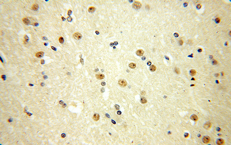 Immunohistochemical of paraffin-embedded human brain using Catalog No:112764(MTA3 antibody) at dilution of 1:100 (under 40x lens)