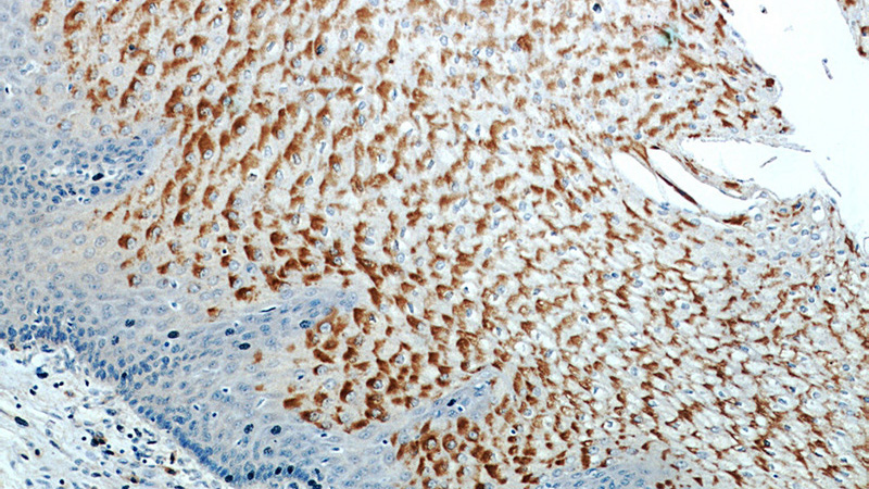 Immunohistochemical of paraffin-embedded human oesophagus using Catalog No:111252(GUF1 antibody) at dilution of 1:50 (under 10x lens)