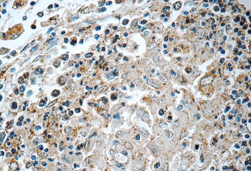 Immunohistochemistry of paraffin-embedded human spleen tissue slide using Catalog No:114732(RNASEL Antibody) at dilution of 1:50 (under 40x lens)