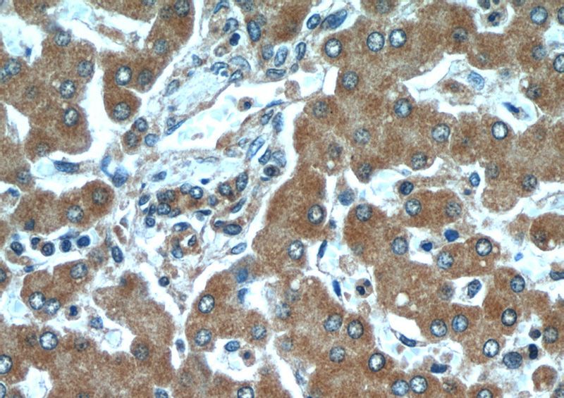 Immunohistochemical of paraffin-embedded human liver using Catalog No:107526(SERPINA10 antibody) at dilution of 1:50 (under 40x lens)