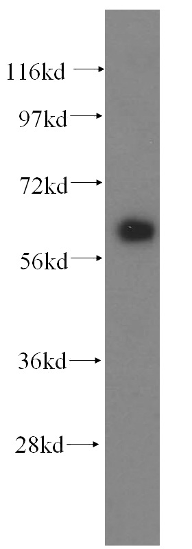 human skeletal muscle tissue were subjected to SDS PAGE followed by western blot with Catalog No:108754(CABC1 antibody) at dilution of 1:800