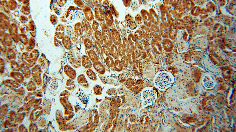 Immunohistochemical of paraffin-embedded human kidney using Catalog No:112215(LHPP antibody) at dilution of 1:100 (under 10x lens)
