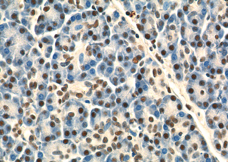 Immunohistochemistry of paraffin-embedded human pancreas tissue slide using Catalog No:108140(API5 Antibody) at dilution of 1:50 (under 40x lens)