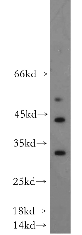 A375 cells were subjected to SDS PAGE followed by western blot with Catalog No:110117(DUSP15 antibody) at dilution of 1:300