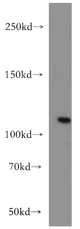 HeLa cells were subjected to SDS PAGE followed by western blot with Catalog No:113872(PIK3CB antibody) at dilution of 1:500