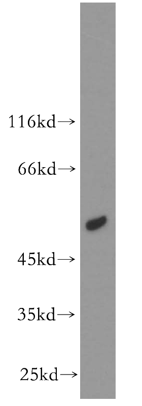 mouse kidney tissue were subjected to SDS PAGE followed by western blot with Catalog No:107749(AOX antibody) at dilution of 1:300