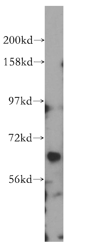SH-SY5Y cells were subjected to SDS PAGE followed by western blot with Catalog No:114649(RGS7 antibody) at dilution of 1:500