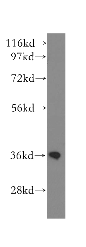 human kidney tissue were subjected to SDS PAGE followed by western blot with Catalog No:109428(CNN3 antibody) at dilution of 1:500