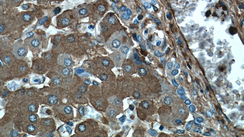 Immunohistochemical of paraffin-embedded human liver using Catalog No:116145(TNIP2 antibody) at dilution of 1:100 (under 40x lens)
