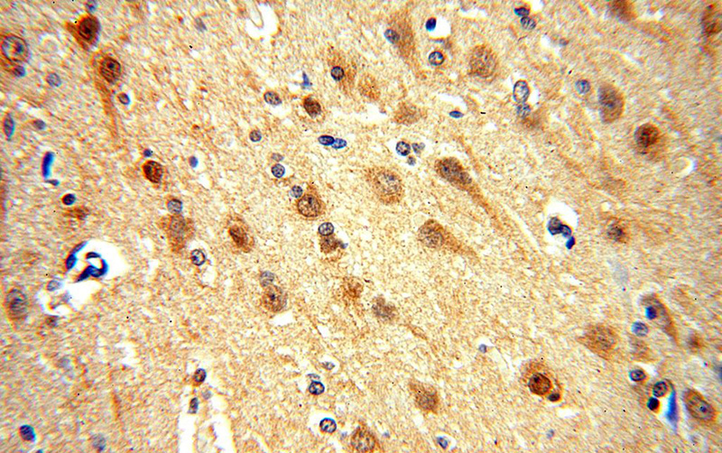 Immunohistochemical of paraffin-embedded human brain using Catalog No:114317(PTPN18 antibody) at dilution of 1:100 (under 40x lens)