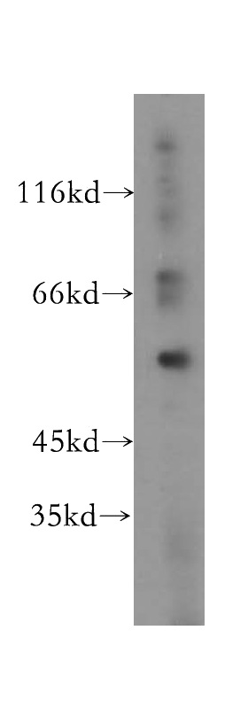 HeLa cells were subjected to SDS PAGE followed by western blot with Catalog No:113264(Noc4L antibody) at dilution of 1:300