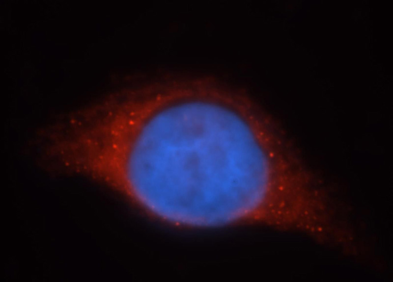 Immunofluorescent analysis of MCF-7 cells, using GSR antibody Catalog No:111177 at 1:25 dilution and Rhodamine-labeled goat anti-rabbit IgG (red).Blue pseudocolor = DAPI (fluorescent DNA dye).
