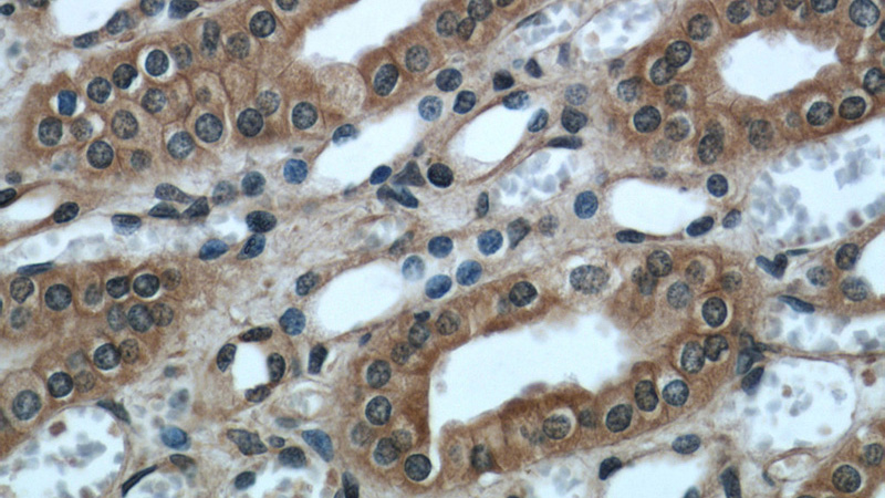Immunohistochemical of paraffin-embedded human kidney using Catalog No:113268(NR3C2 antibody) at dilution of 1:50 (under 40x lens)