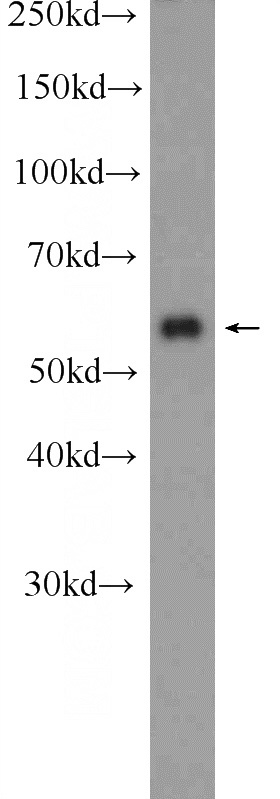 HeLa cells were subjected to SDS PAGE followed by western blot with Catalog No:114996(SCHIP1 Antibody) at dilution of 1:600
