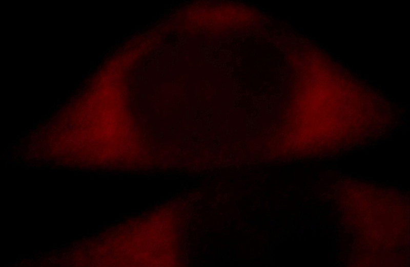 Immunofluorescent analysis of Hela cells, using BZW1 antibody Catalog No:108559 at 1:25 dilution and Rhodamine-labeled goat anti-rabbit IgG (red).