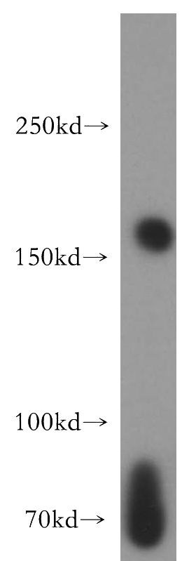 K-562 cells were subjected to SDS PAGE followed by western blot with Catalog No:113375(NUP153 antibody) at dilution of 1:500