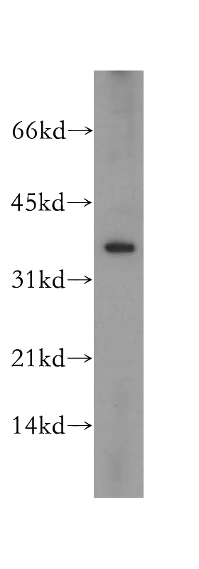 HeLa cells were subjected to SDS PAGE followed by western blot with Catalog No:114823(RPP38 antibody) at dilution of 1:500