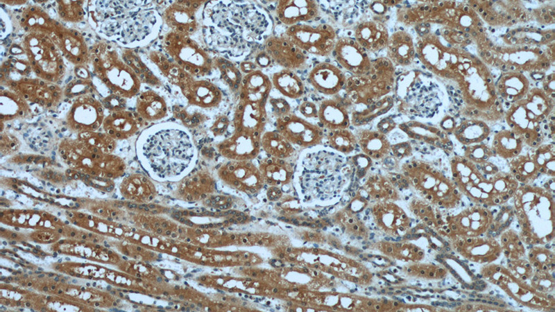 Immunohistochemical of paraffin-embedded human kidney using Catalog No:109865(CD234 antibody) at dilution of 1:50 (under 10x lens)