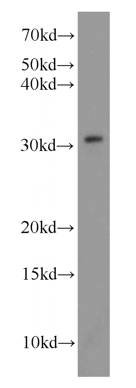 HeLa cells were subjected to SDS PAGE followed by western blot with Catalog No:112735(MORF4L2 antibody) at dilution of 1:800