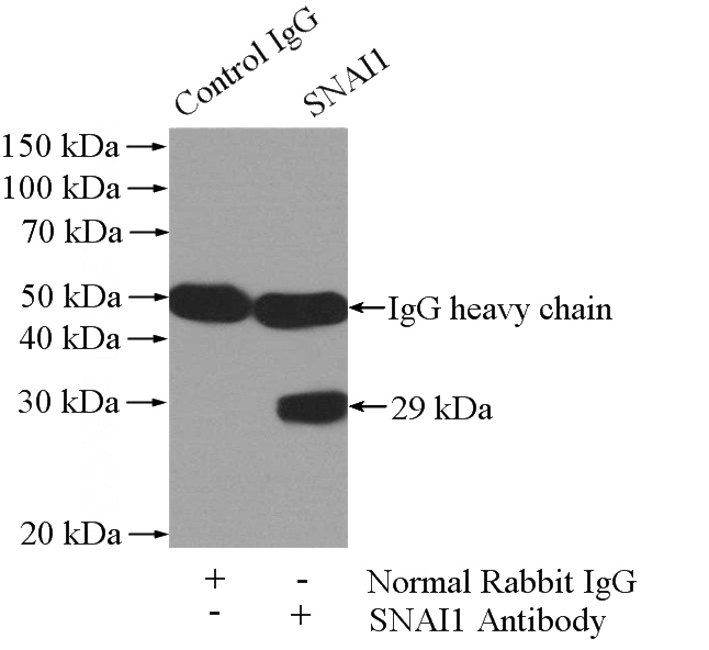 IP Result of anti-SNAI1 (IP:Catalog No:115441, 4ug; Detection:Catalog No:115441 1:600) with MCF-7 cells lysate 1040ug.