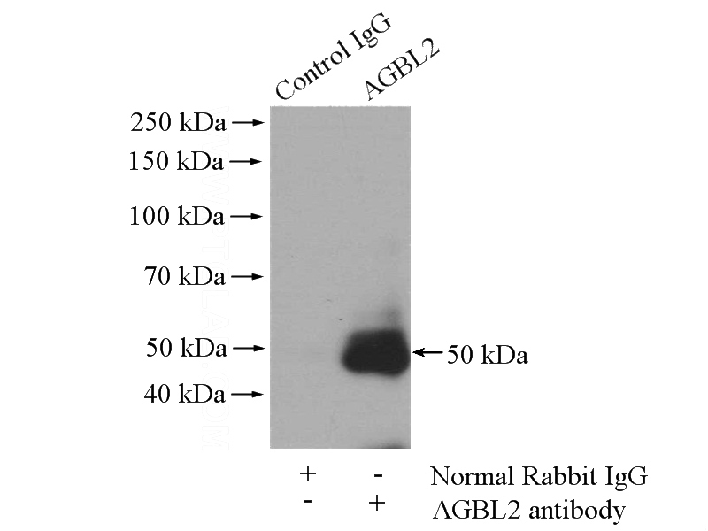 IP Result of anti-AGBL2 (IP:Catalog No:107915, 4ug; Detection:Catalog No:107915 1:300) with HeLa cells lysate 1200ug.
