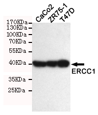 Western blot detection of ERCC1 in T47D,ZR75-1,CaCO2 and Molt-4 cell lysate using ERCC1 mouse mAb (1:1000 diluted).Predicted band size: 39KDa.Observed band size: 39KDa.