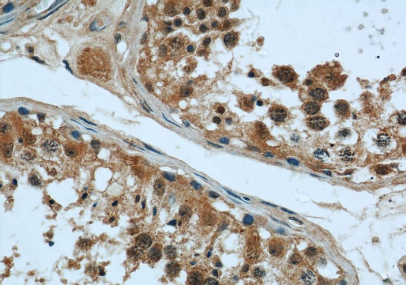 Immunohistochemical of paraffin-embedded human testis using Catalog No:112000(KIF15 antibody) at dilution of 1:50 (under 40x lens)