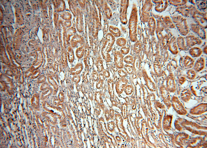 Immunohistochemical of paraffin-embedded human kidney using Catalog No:114141(PPOX antibody) at dilution of 1:50 (under 10x lens)