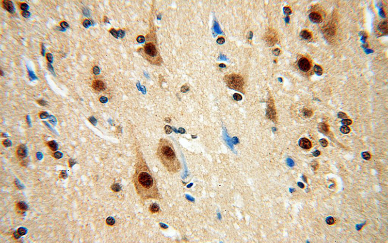 Immunohistochemical of paraffin-embedded human brain using Catalog No:114848(RSPH3 antibody) at dilution of 1:50 (under 40x lens)