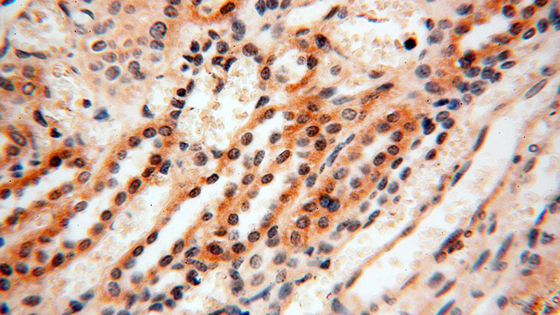 Immunohistochemical of paraffin-embedded human kidney using Catalog No:108928(CAMSAP1L1 antibody) at dilution of 1:100 (under 40x lens)