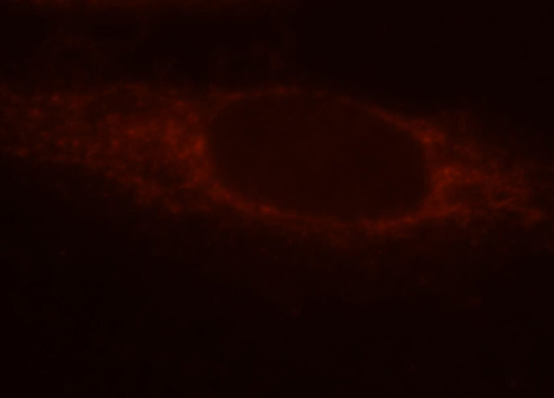 Immunofluorescent analysis of MCF-7 cells, using Catalog No:112281 and Rhodamine-labeled goat anti-rabbit IgG (red).