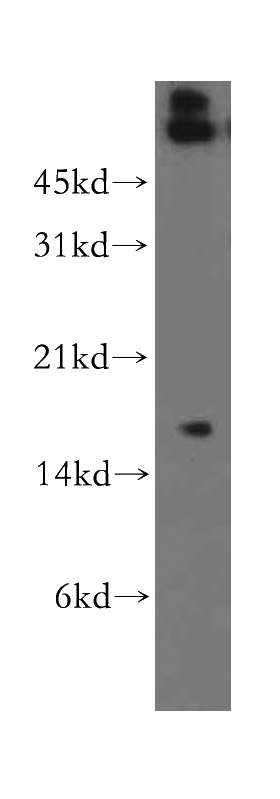 human heart tissue were subjected to SDS PAGE followed by western blot with Catalog No:112760(MPZL1 antibody) at dilution of 1:400