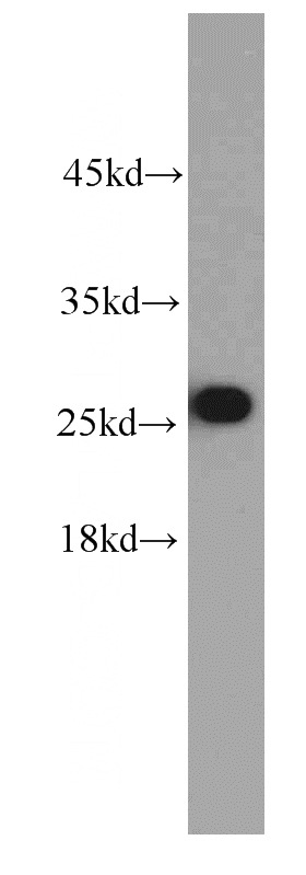 K-562 cells were subjected to SDS PAGE followed by western blot with Catalog No:107492(RAB27A antibody) at dilution of 1:1000
