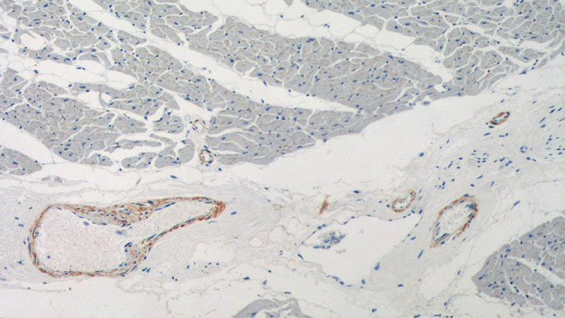 Immunohistochemistry of paraffin-embedded human heart tissue slide using Catalog No:116334(TRANSGELIN-1-specific Antibody) at dilution of 1:2000 (under 10x lens).